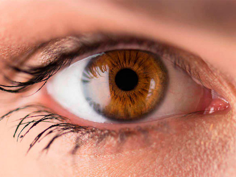 Retinopatía Diabética